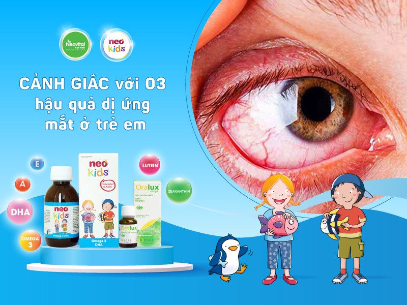 CẢNH GIÁC với 03 hậu quả dị ứng mắt ở trẻ em