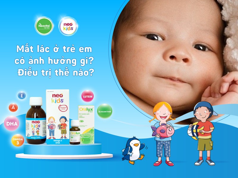 Mắt lác ở trẻ em có ảnh hưởng gì? Điều trị thế nào?