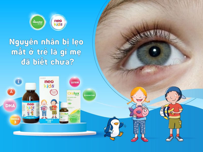 Nguyên nhân bị lẹo mắt ở trẻ là gì mẹ đã biết chưa?