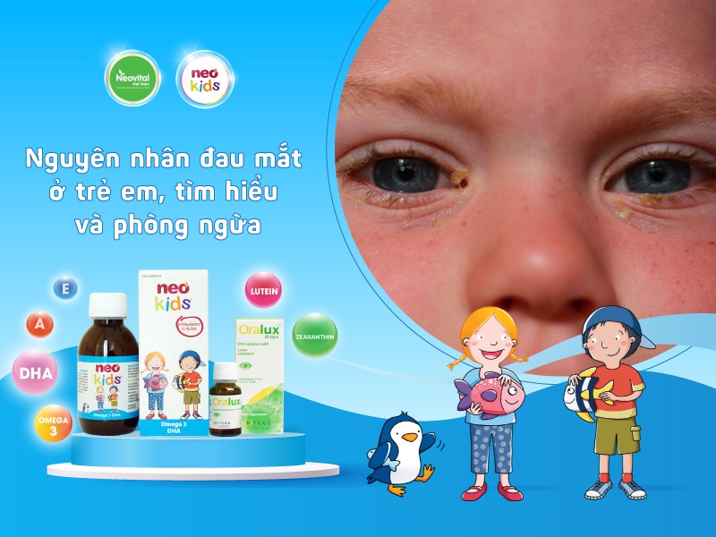 Nguyên nhân đau mắt ở trẻ em, tìm hiểu và phòng ngừa