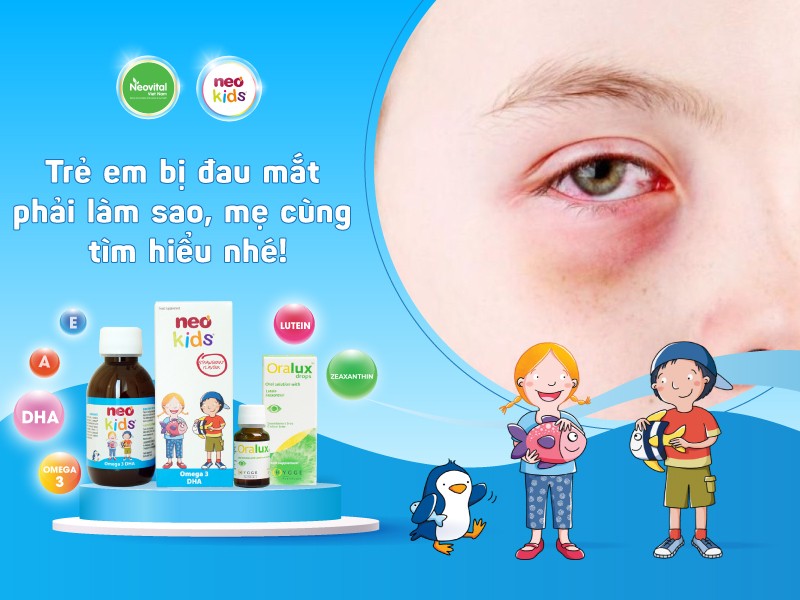 Trẻ em bị đau mắt phải làm sao, mẹ cùng tìm hiểu nhé!